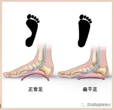 胡霞医生:保护足踝健康的秘诀