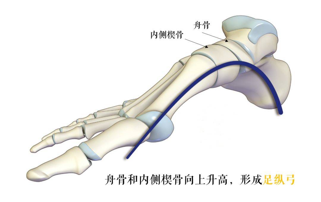 马蹄内翻足的畸形的几个方面